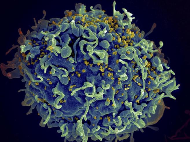 Partículas de VIH infectando una célula T, del sistema defensivo...