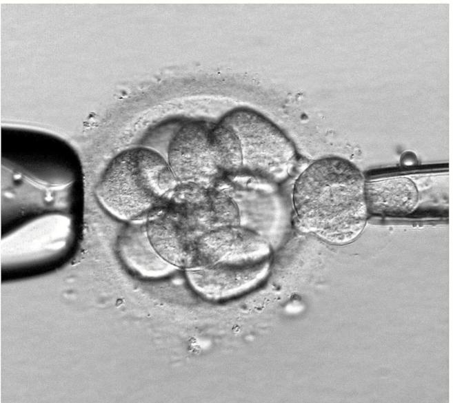 Extracción de una célula embrionaria para un diagnóstico...