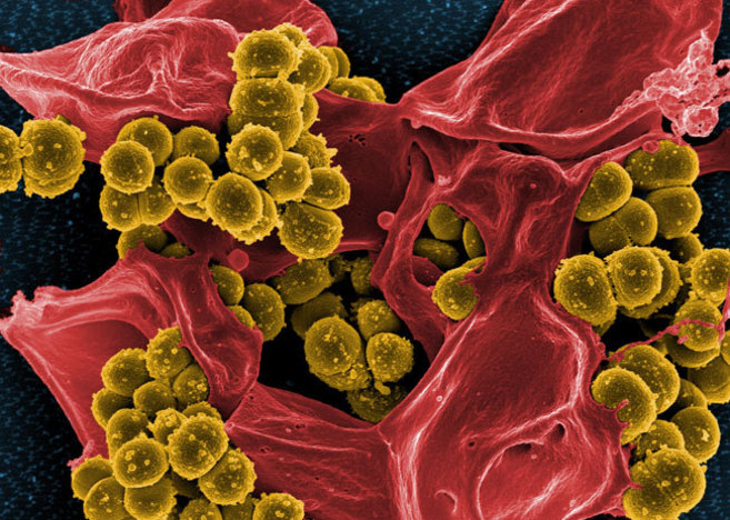 Imagen de la bacteria 'Staphylococcus aureus' resistente a...