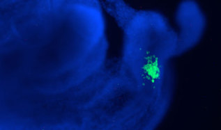 Clulas pluripotentes humanas en un embrin de ratn.
