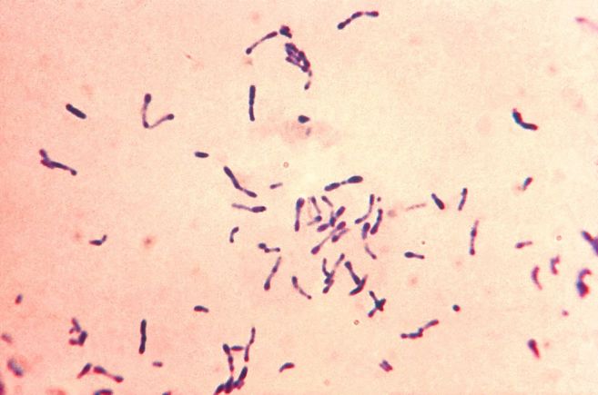 Imagen al microscopio de la bacteria de la difteria
