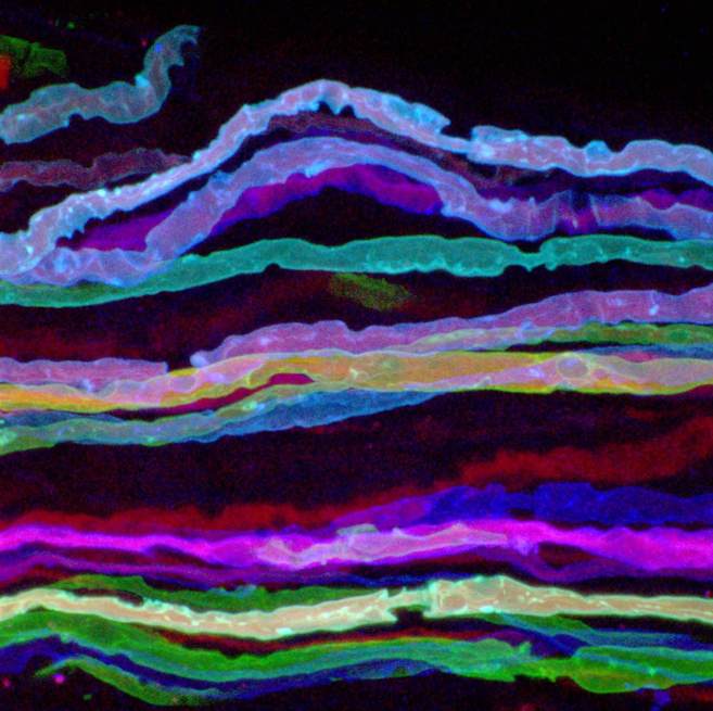 Imagen del nervio perifrico que recuerda al arcoris pintado por...
