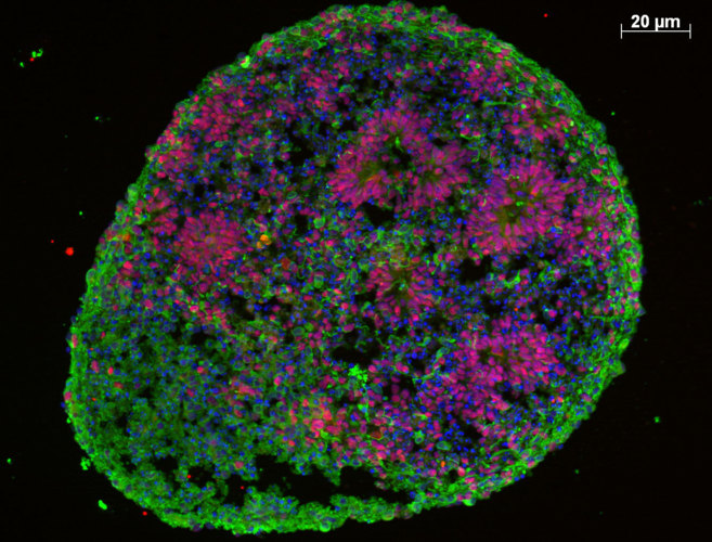 Imagen de uno de los "cerebros en miniatura" u organoides.