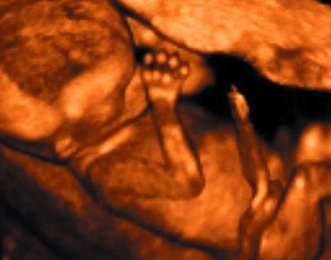 Vista de un feto de 12 semanas con una ecografa de cuatro...