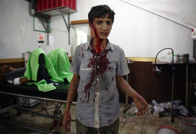 Un joven sirio mira a la cámara con dolor y desconcierto en un...