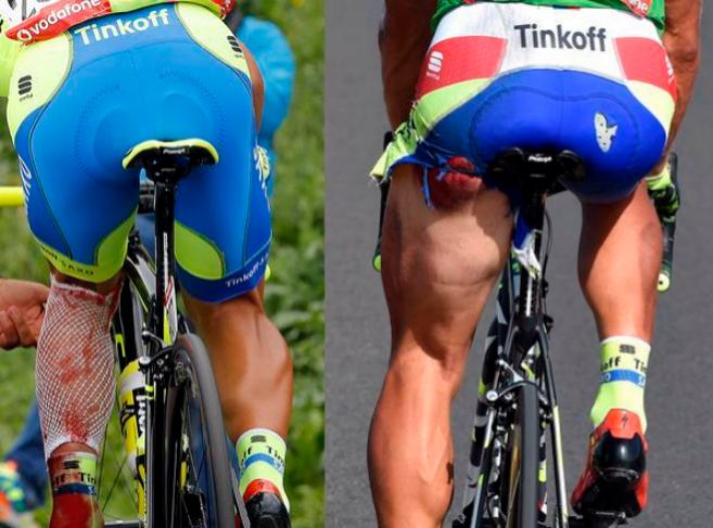 Los ciclistas Paulinho y Sagan, tras sufrir sendos atropellos en plena...