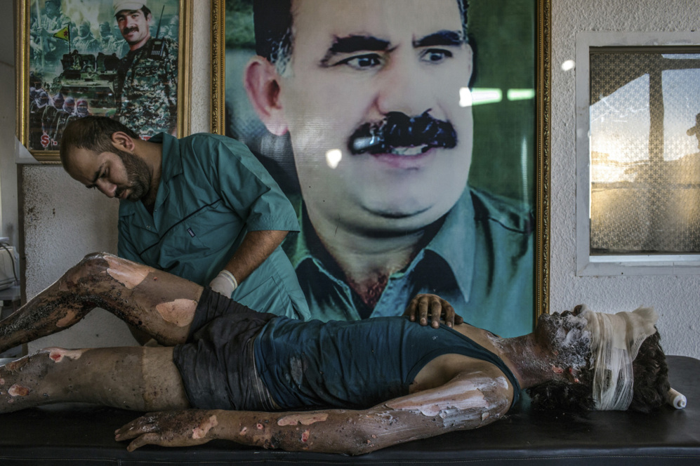 Un combatiente del IS en el Hospital Kurdish (Noticias, primer premio,...