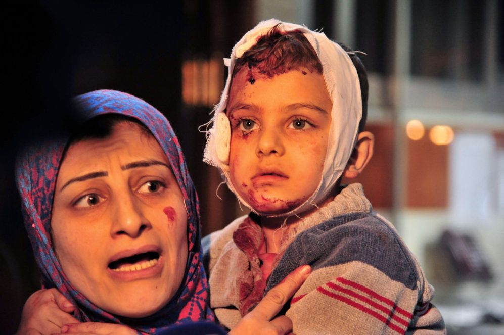 Una mujer y su hijo heridos protestan en un hospital de Damasco.