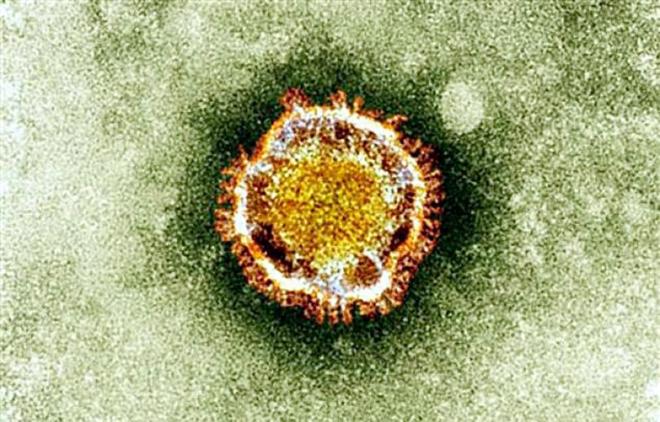 Imagen de una cepa de la familia de los coronavirus.