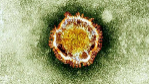 Imagen de una cepa de la familia de los coronavirus.