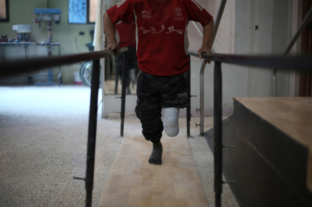 Un nio sirio acude a sesiones de rehabilitacin despus de la...