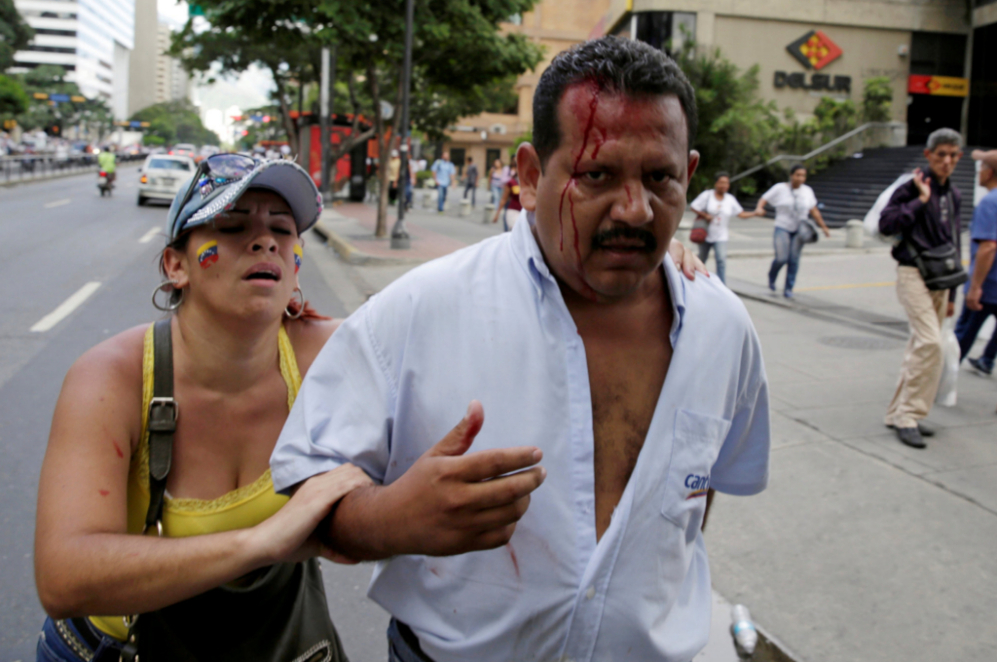 Un manifestante herido durante la marcha de la oposicin venezolana...