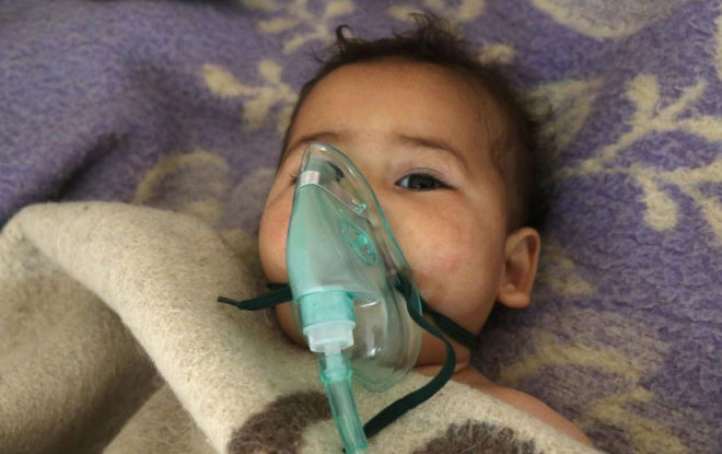 Un niño sirio afectado por el ataque químico en Jan Seijin.