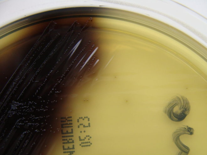 Cultivo de la bacteria Listeria monocytogenes.