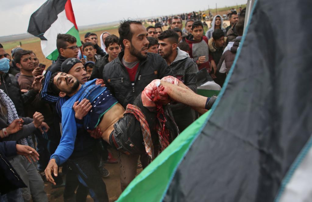 Un joven palestino herido es socorrido durante la concentracin...