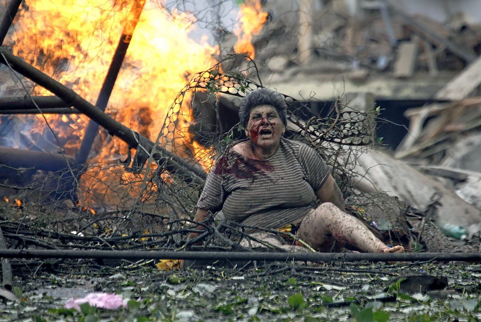 Una mujer herida en el bombardeo ruso contra Gori en 2008.