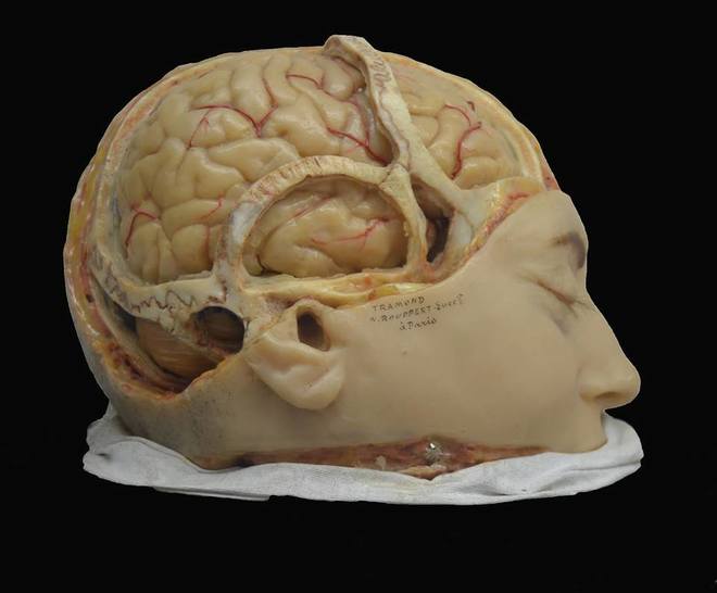 Modelo en cera del cerebro humano del último tercio del XIX.