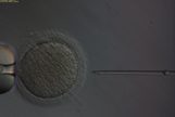 Esperma procedente de tejido inmaduro de macaco congelado siendo introducido en un vulo para la fecundacin