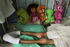 A girl lays on a bed at the "J.M. de los Rios" Children Hospital in <HIT>Caracas</HIT>, Venezuela June 22, 2017. Picture taken June 22, 2017. REUTERS/Marco Bello - RC1634607490