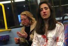 Melania Geymonat y su novia tras la brutal agresin que sufrieron en un autobs.