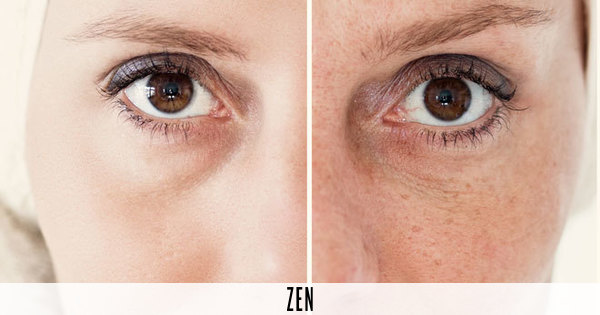 Las 10 claves para prevenir el fotoenvejecimiento | Bienestar