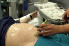 Una mujer se realiza una ecografa de seguimiento de su embarazo.