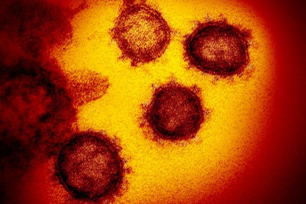 Coronavirus vs. gripe comn: Qu cosas son iguales en ambas? Pueden diferenciarse fcilmente?