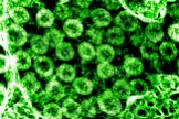 - (United States), 01/03/2020.- An undated handout picture made available by the National Institutes of Health (NIH) shows a transmission electron micrograph of SARS-CoV-2 virus particles, also known as 2019-nCoV, the virus that causes Covid-19, isolated from a patient (issued 01 March 2020). The image was captured and color-enhanced at the National Institute of Allergy and Infectious Diseases (NIAID) Integrated Research Facility (IRF) in Fort Detrick, Maryland, USA. US health officials announced on 29 February 2020 the first confirmed death from the new lt;HIT gt;coronavirus lt;/HIT gt; in the country in Washington State. The novel lt;HIT gt;coronavirus lt;/HIT gt; is on the verge of spreading across the world as more Covid-19 cases are emerging outside China with outbreaks in South Korea, Italy and Iran. (Italia, Corea del Sur, Estados Unidos) EFE/EPA/NIAID/NATIONAL INSTITUTES OF HEALTH HANDOUT HANDOUT EDITORIAL USE ONLY/NO SALES