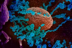 This image obtained March 12, 2020 courtesy of The National Institutes of Health(NIH)/NIAD-RML shows a scanning electron microscope image of SARS-CoV-2 (round blue objects) emerging from the surface of cells cultured in the lab, SARS-CoV-2, also known as 2019-nCoV, is the virus that causes COVID-19, the virus shown was isolated from a patient in the US. - US President Donald Trump announced a shock 30-day ban on travel from mainland Europe over the lt;HIT gt;coronavirus lt;/HIT gt; pandemic that has sparked unprecedented lockdowns, widespread panic and another financial market meltdown March 12, 2020. Trump's unexpected move in a primetime TV address from the Oval Office pummelled stock markets, as traders fretted about the economic impact of the outbreak that is on a seemingly relentless march across the planet. (Photo by Handout / National Institutes of Health / AFP) / RESTRICTED TO EDITORIAL USE - MANDATORY CREDIT "AFP PHOTO /NATIONAL INSTITUTES OF HEALTH/NIAD-RML/HANDOUT " - NO MARKETING