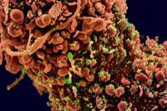 Una clula infectada por el SARS-CoV-2 (en verde)