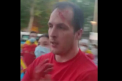 Herido en la cabeza durante un ataque en Madrid cuando protestaba contra el Gobierno
