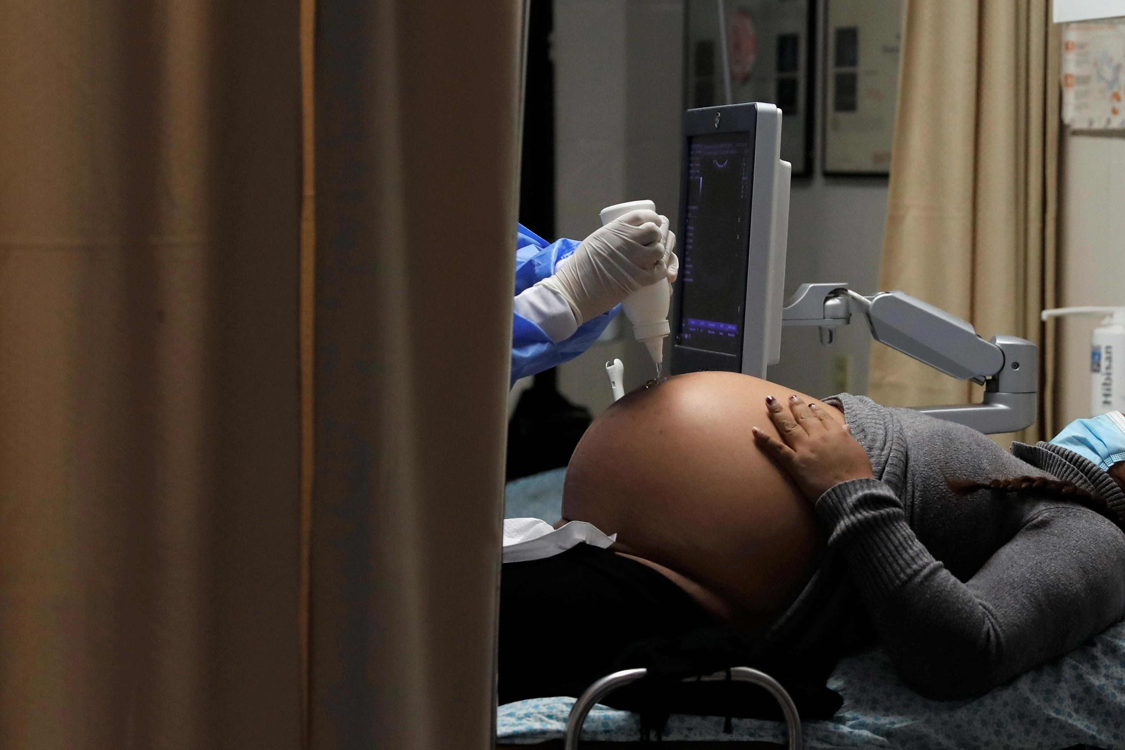 Una mujer embarazada se somete a una ecografa.
