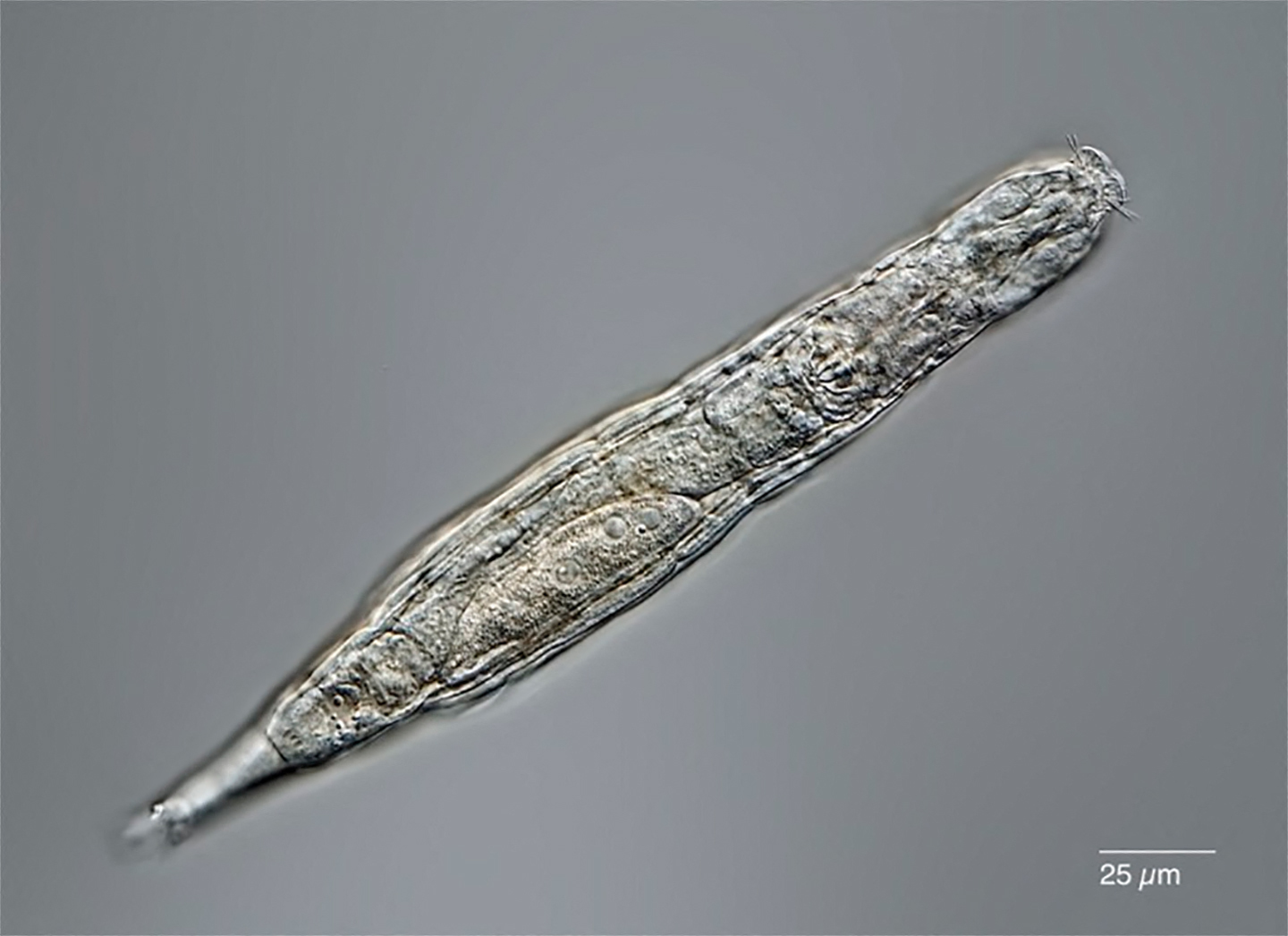 Los animlaes microscpicos, Rotferos bdelloides