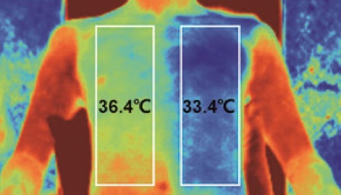 Comparación de la temperatura de la piel: un lado con algodón y otro con el nuevo tejido refrigerante