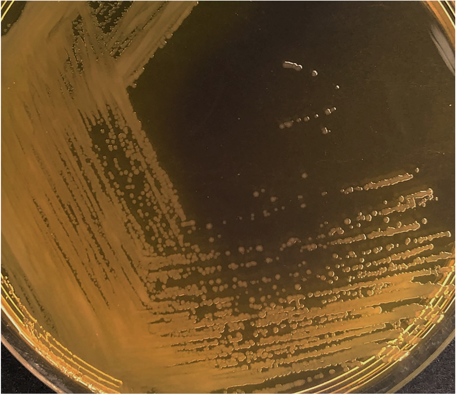 La bacteria 'Pseudomonas putida' segrega sustancias tóxicas para otras bacterias