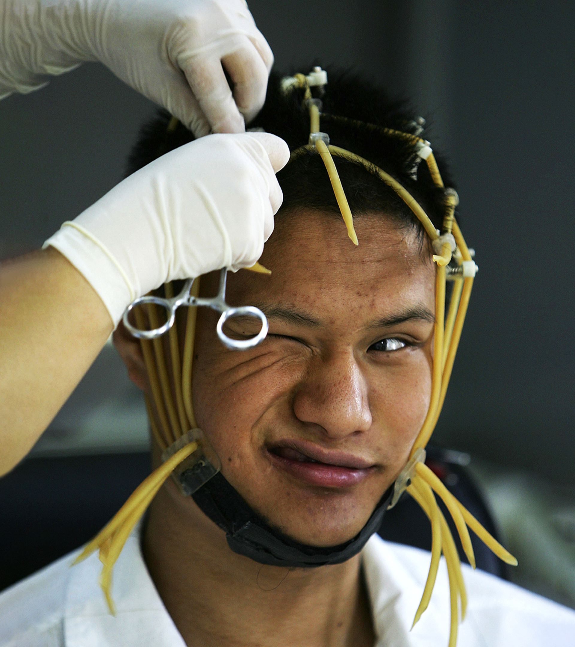 Un joven chino adicto a Internet recibe un electroencefalograma en el Hospital Central de la Regin Militar de Pekn.