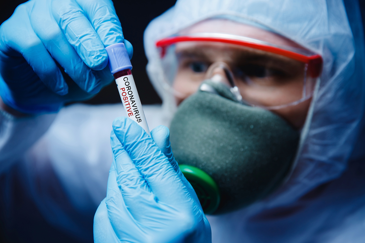 Personal sanitario analiza una muestra de SARS-CoV-2 en un laboratorio.