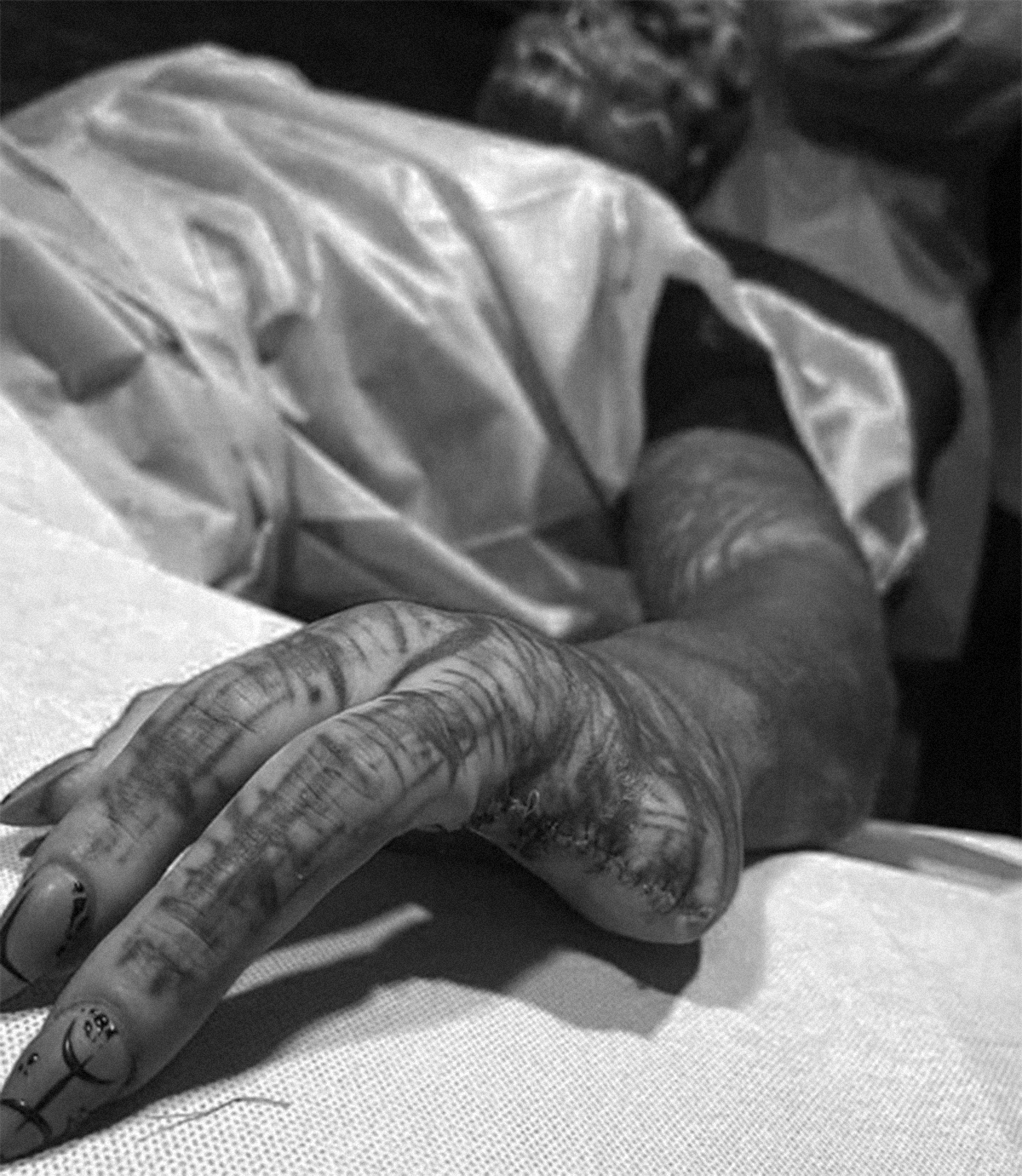 Y dos dedos amputados (del hombre que se ha tatuado hasta los ojos)