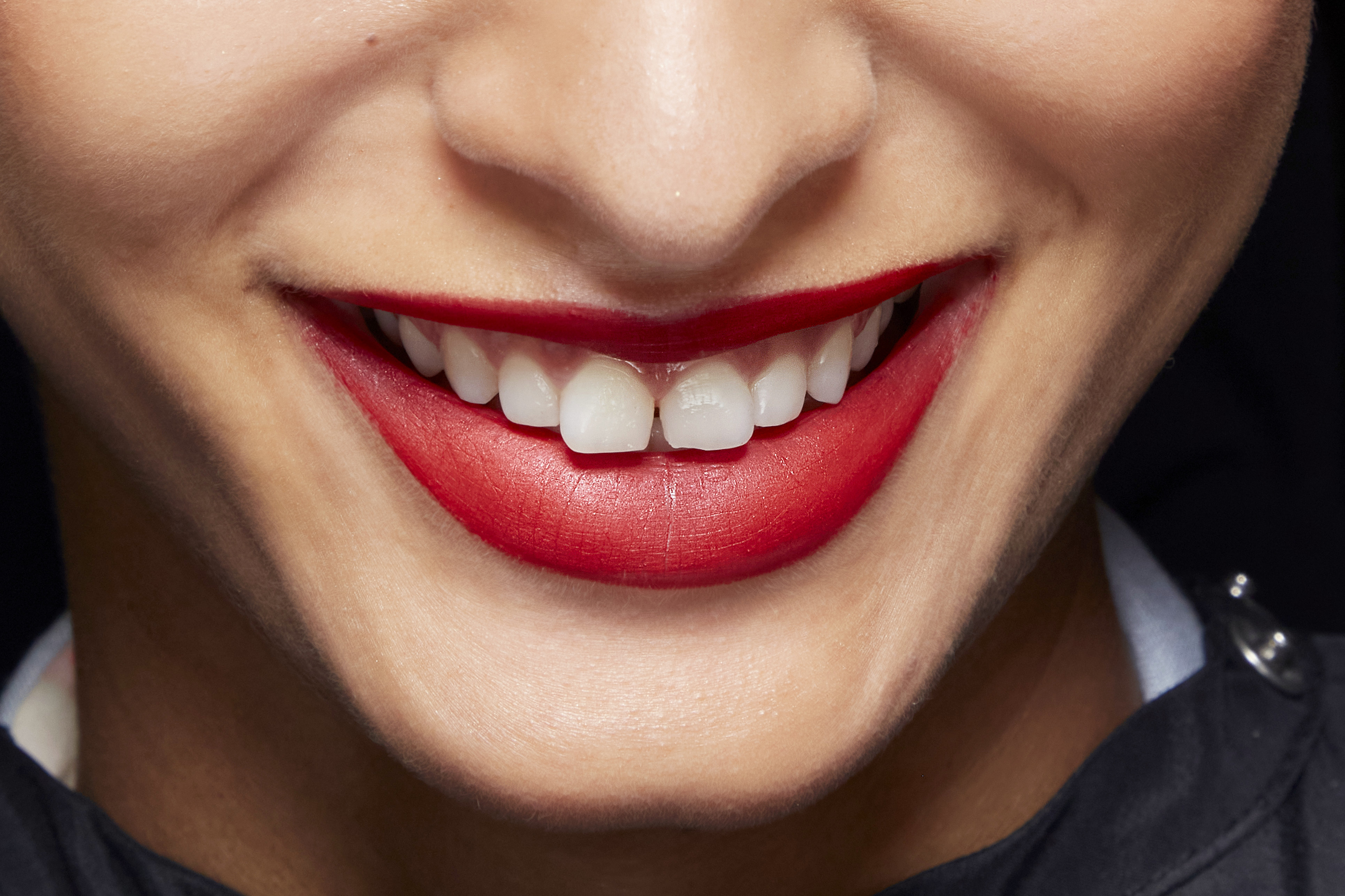 Siempre a favor de los dientes blancos, pero cuidado con los blanqueamientos excesivos y sus consecuencias.