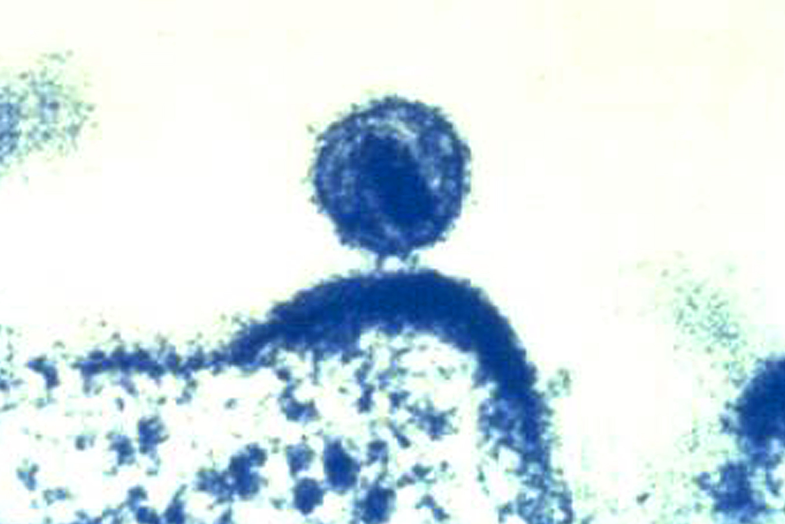 Imagen coloreada de un virus VIH facilitada por el Instituto Nacional de Alergias y Enfermedades Infecciosas