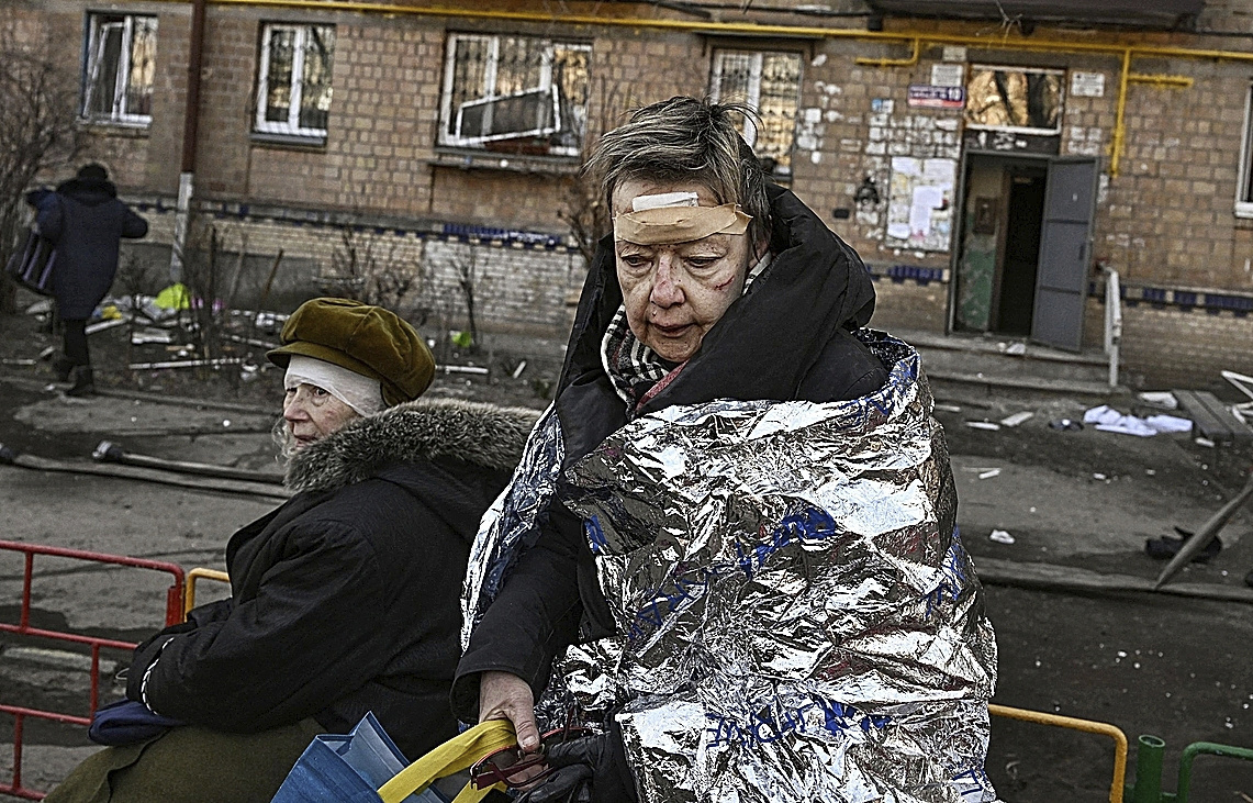 Dos mujeres heridas, tras recibir asistencia médica en Kiev.
