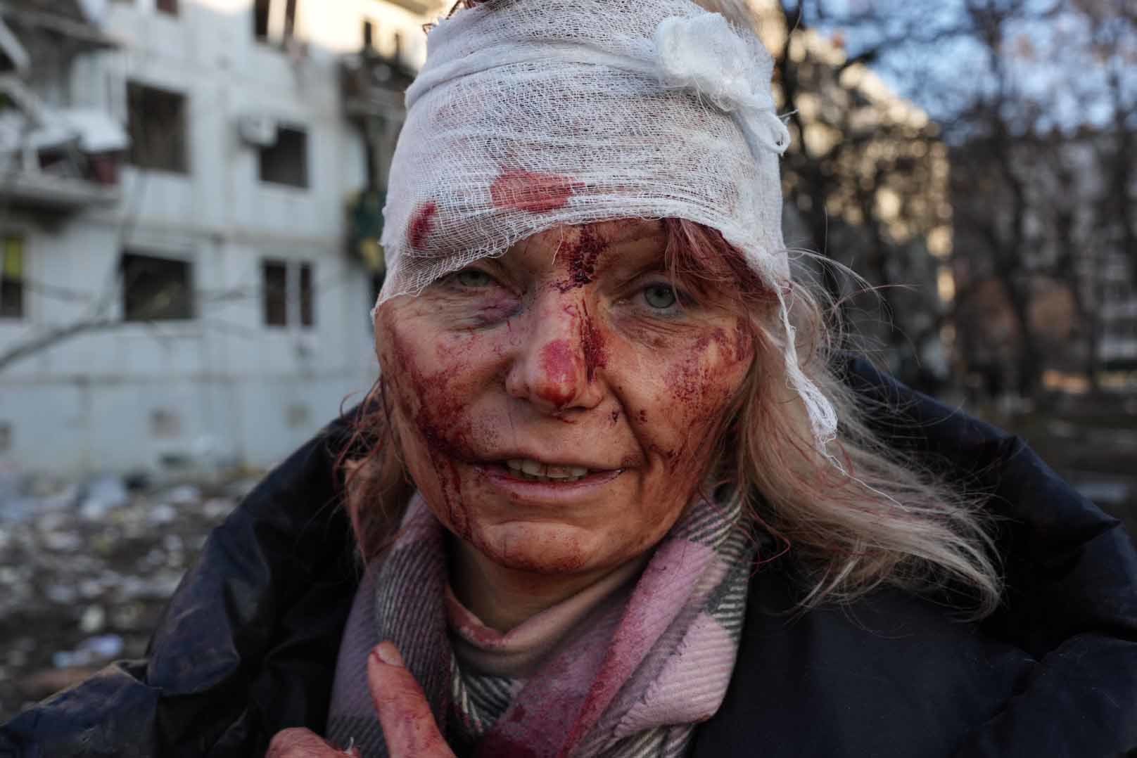 Olena Kurilo, una de las primeras heridas de la guerra, en Jarkov.
