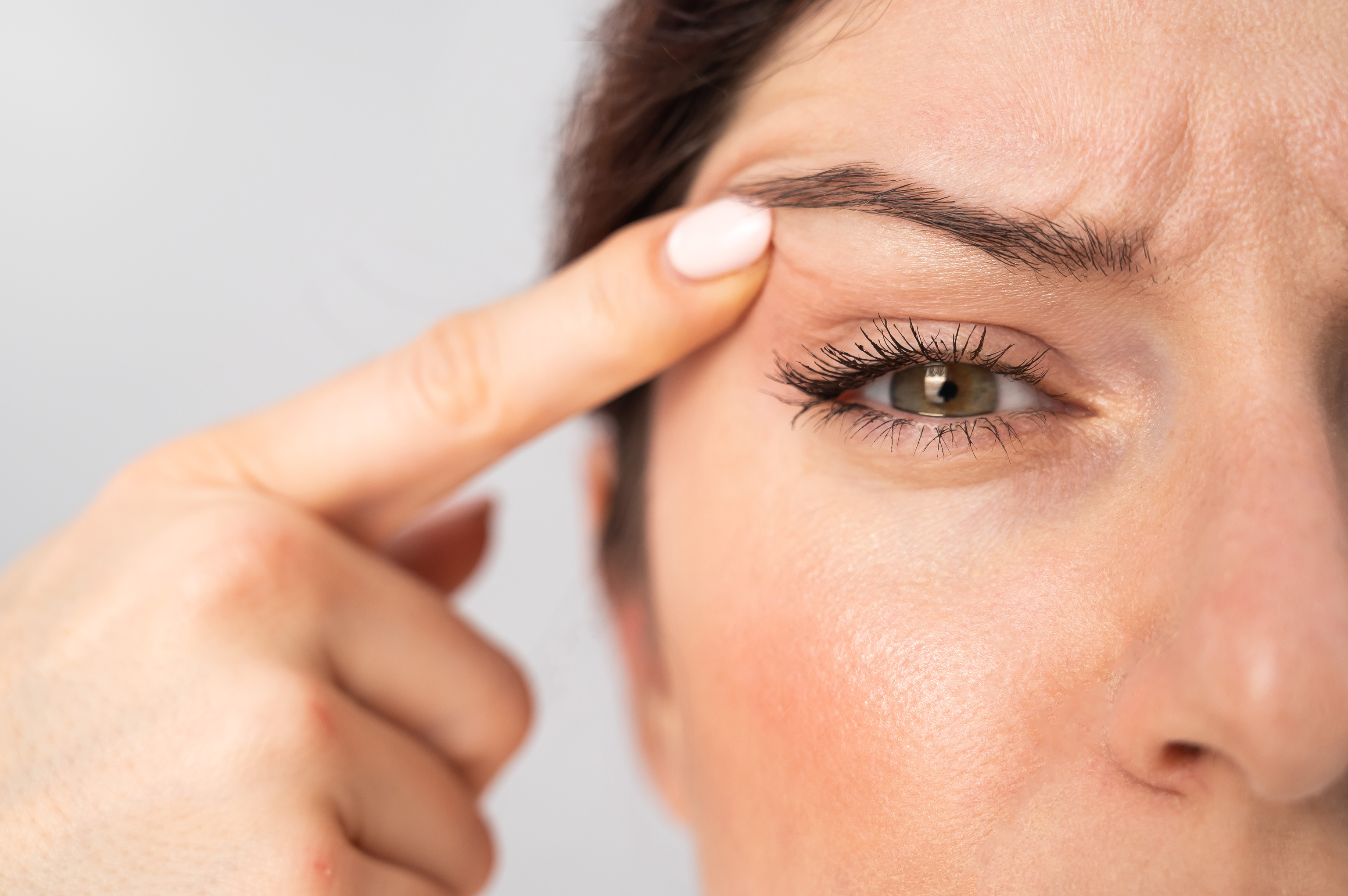 Arrugas, rojeces y acn: as nos estropea la piel la ansiedad y cmo podemos evitarlo