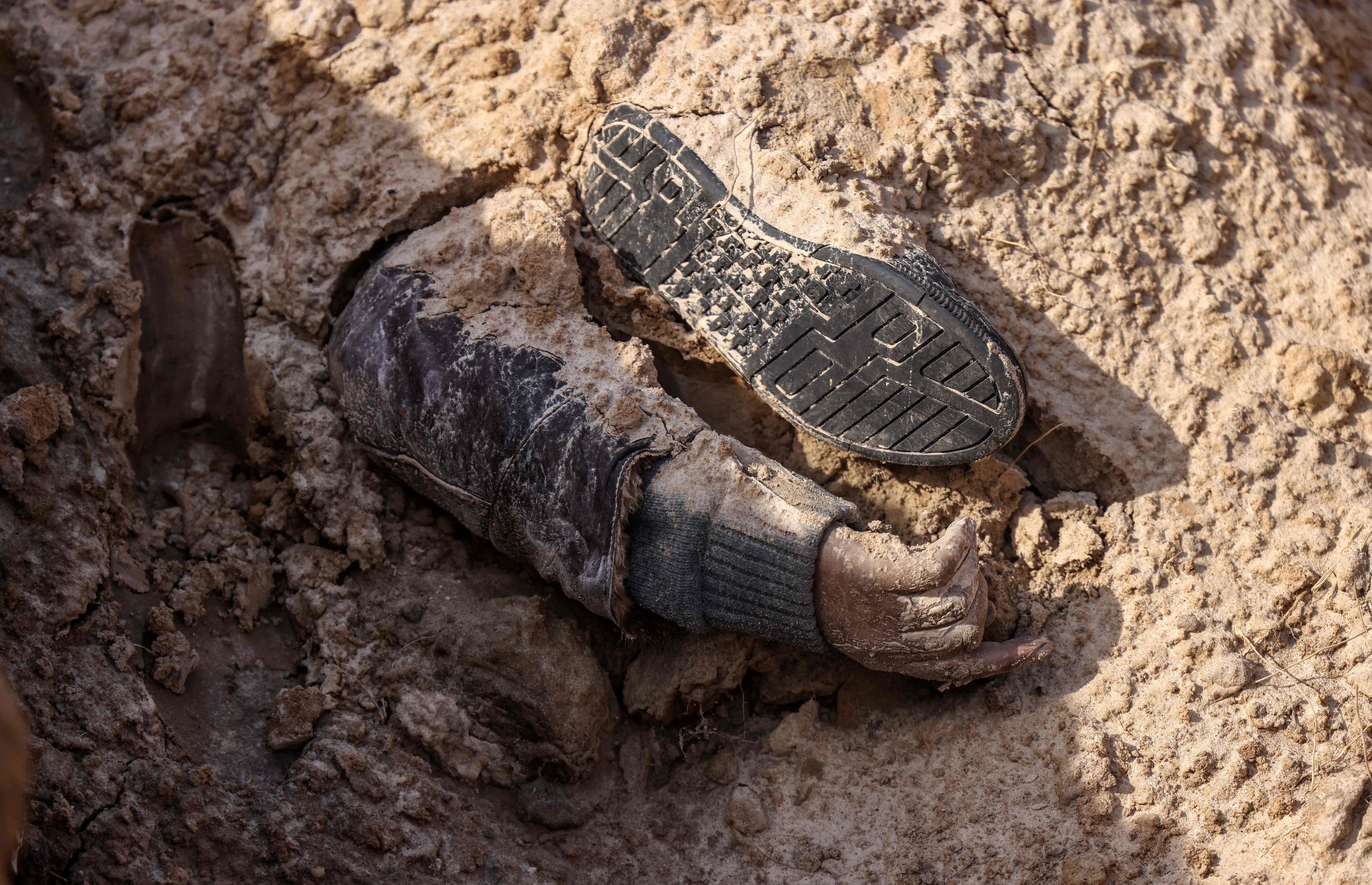 Dedos y brazos rotos, heridas de arma blanca… Las pruebas de los crímenes de guerra en los cuerpos mutilados