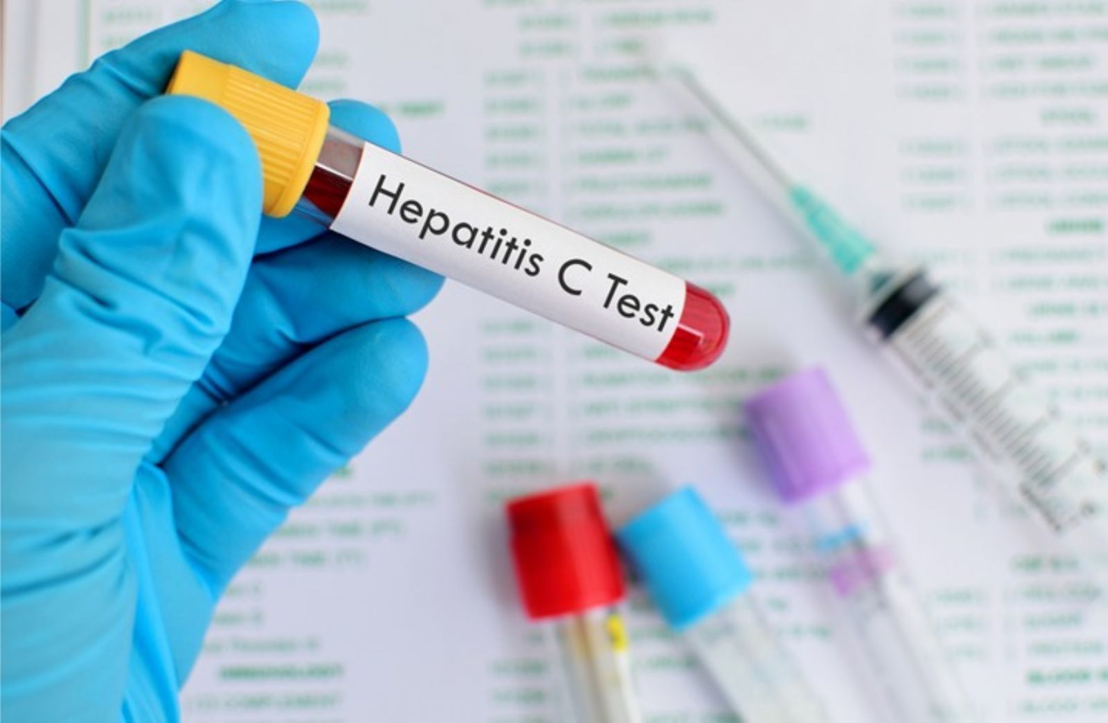 La OMS confirma la primera muerte de un niño por hepatitis aguda en Reino Unido
