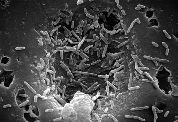 Detalle de la bacteria 'M. chelonae' bajo el microscopio.