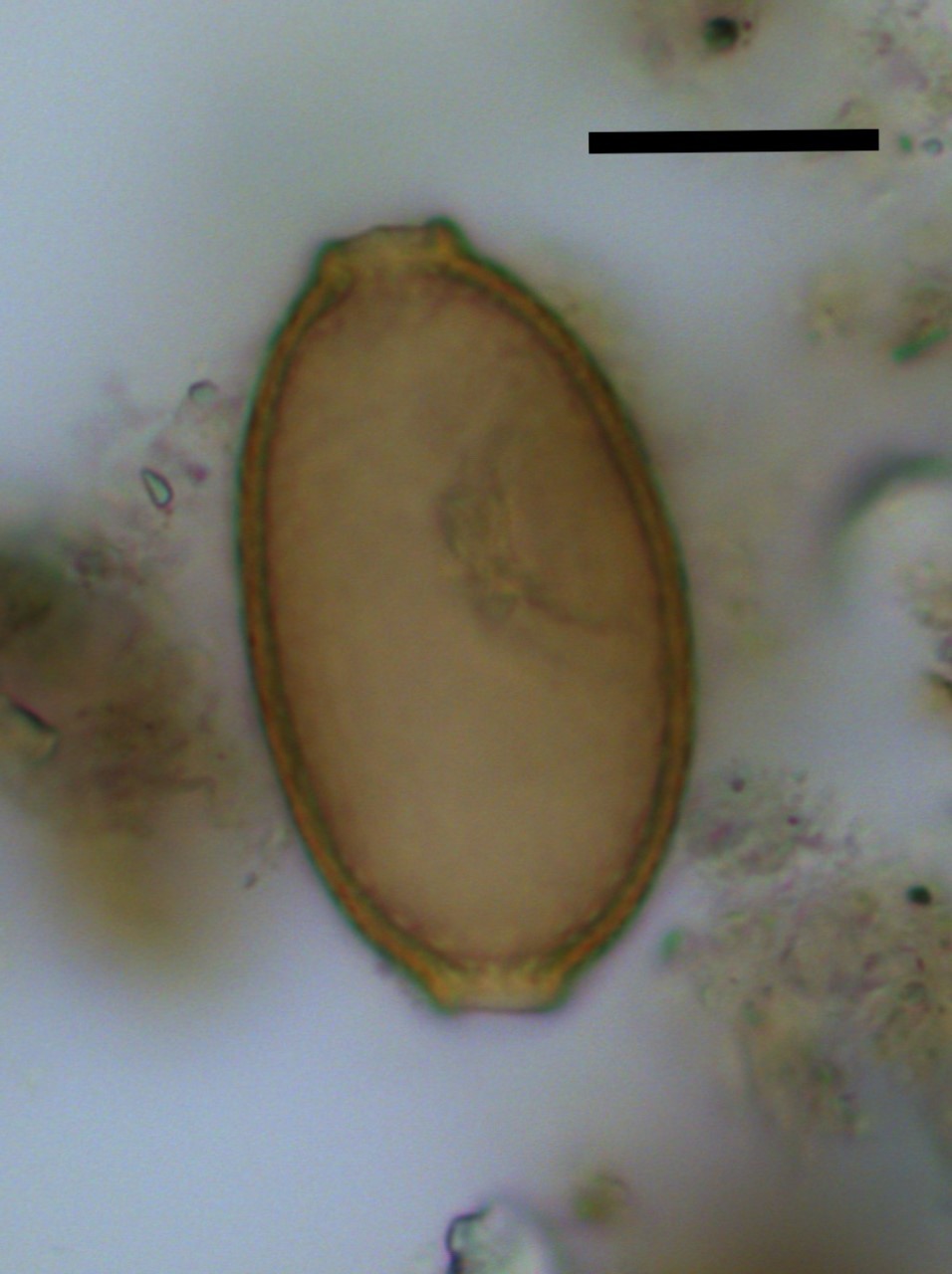 Vista al microscopio de un huevo de un parásito hallado en heces