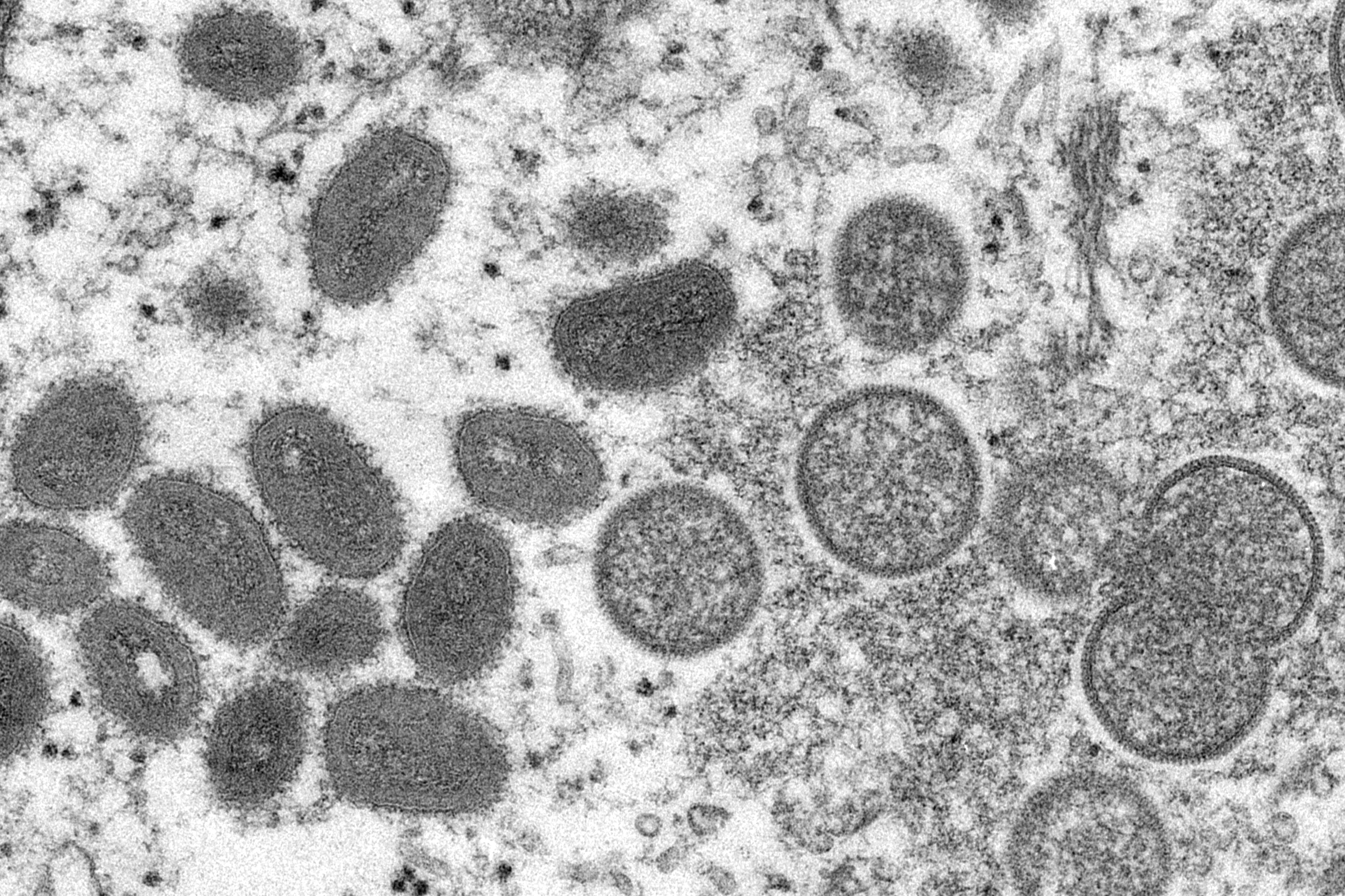 Imagen de microscopio cedida por CDC de EEUU que muestra células infectadas con la viruela del mono.