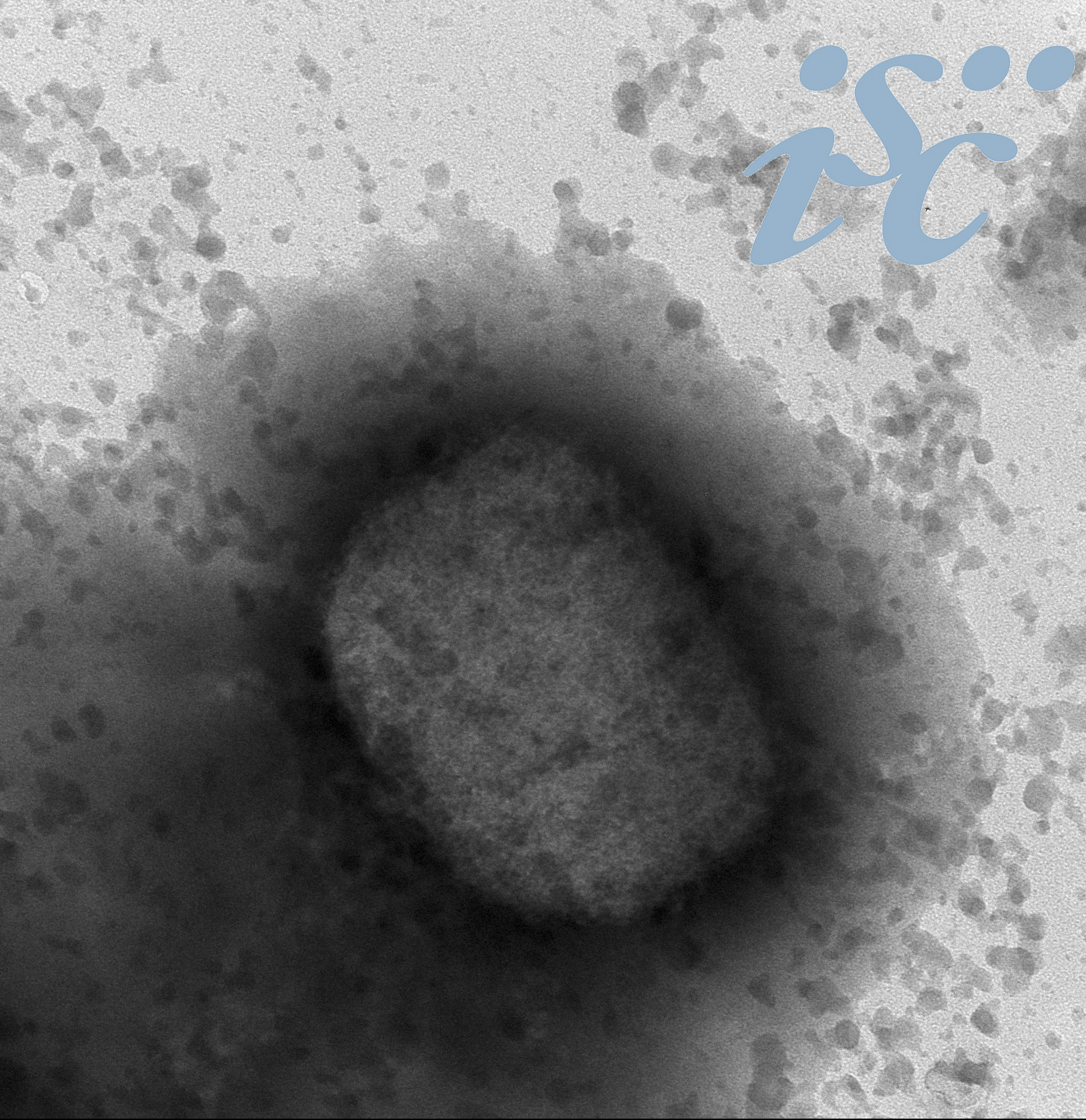 Imagen del virus de la viruela del mono observado a través de microscopía electrónica, facilitada por el Instituto de Salud Carlos III (ISCIII).