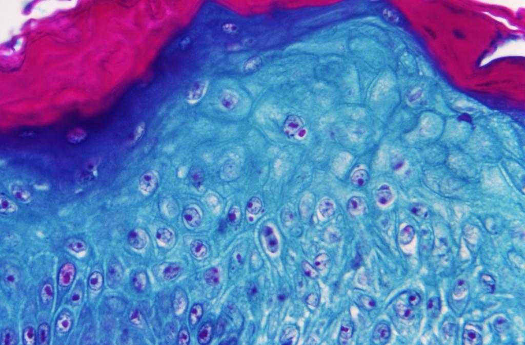 Detail of a sample of skin infected with monkeypox under a microscope.